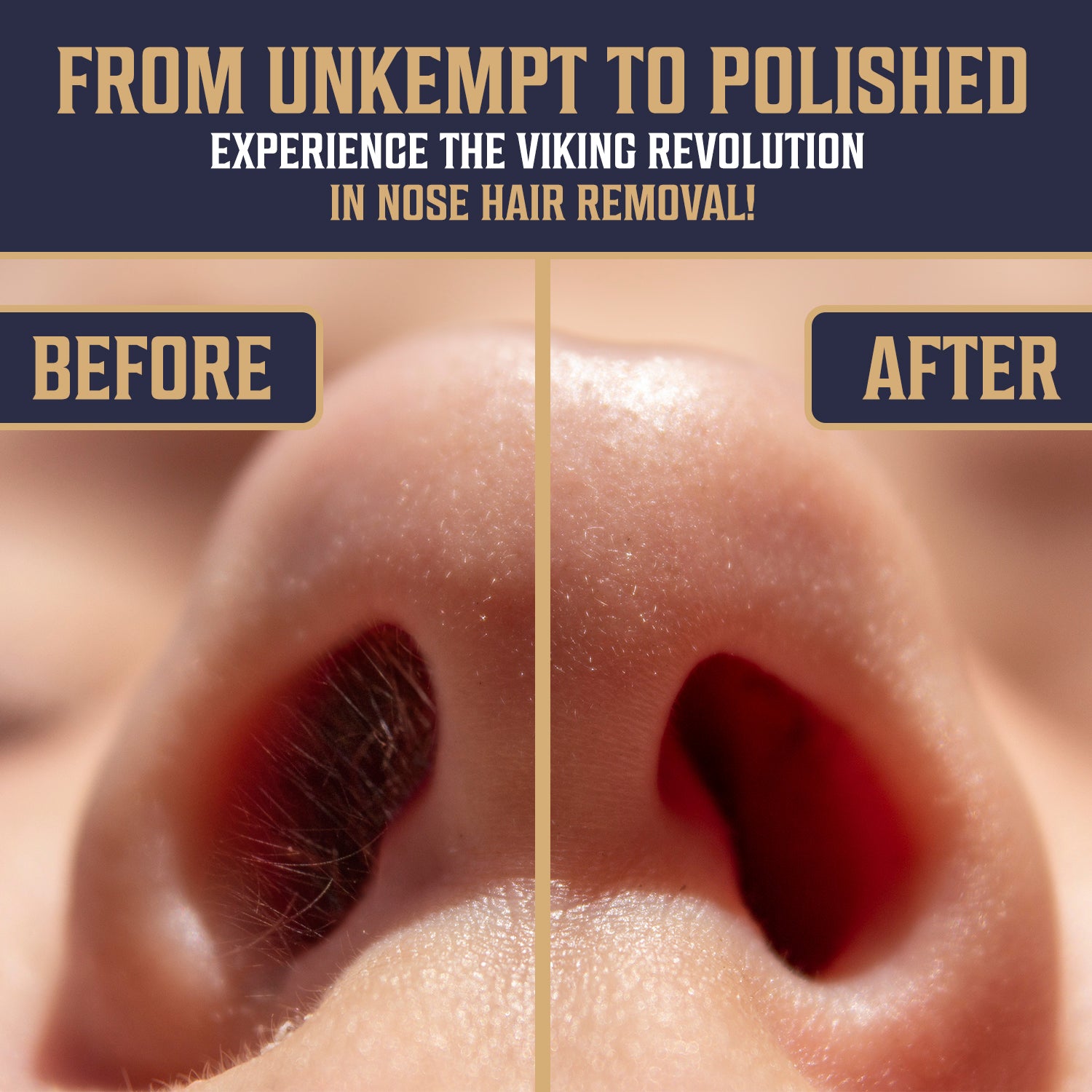 Before and after shot of nostrils using the Nose Wax Kit for long-lasting hair removal results.