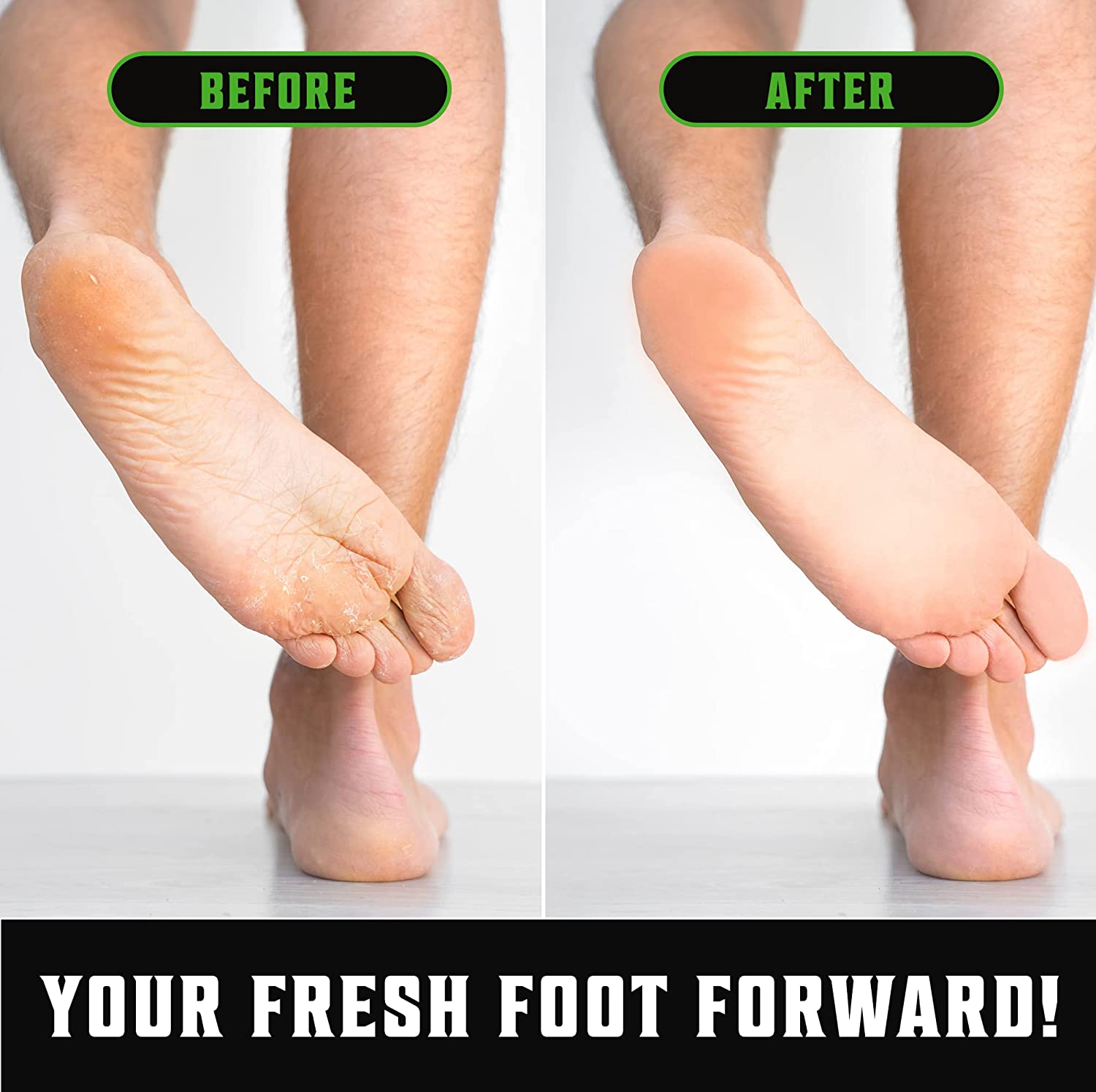 Before and after comparison of feet, showing improved skin texture. Thanks to our Tea Tree Oil Body Wash - 2 Pack, your fresh foot forward is just a step away!