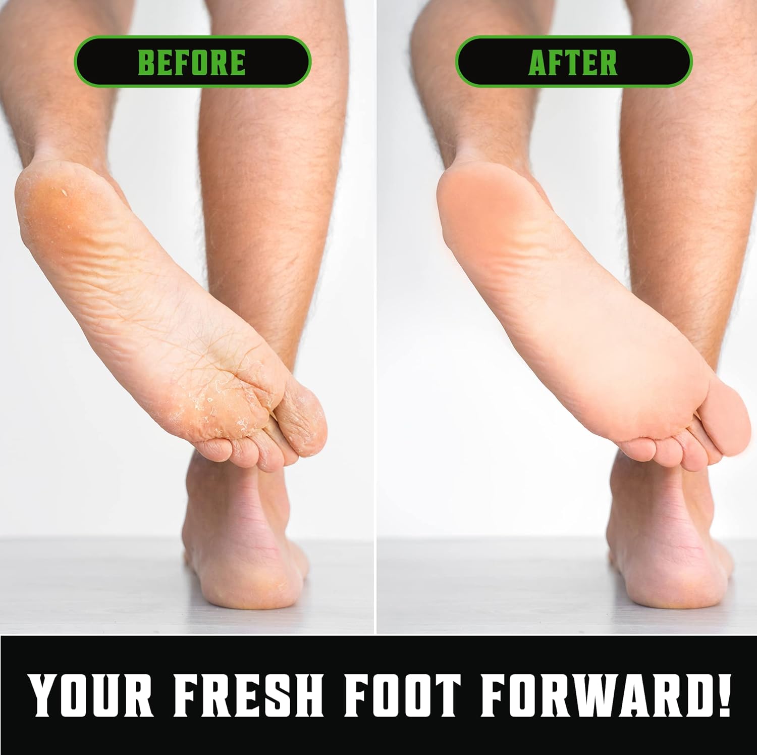 Before and after feet pic—dry to smooth with Tea Tree Oil Body Wash (12oz). Fresh Foot Forward!.