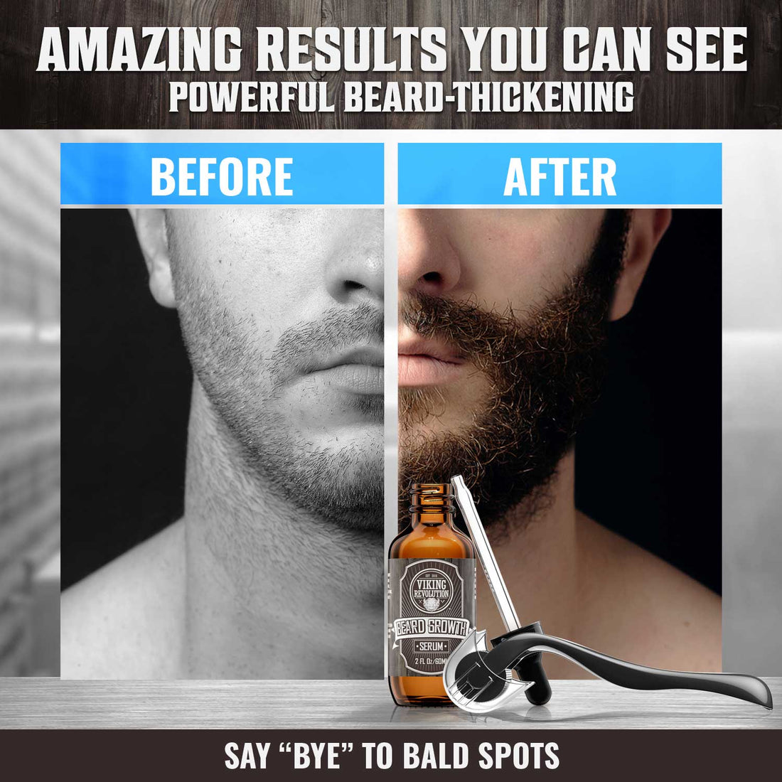 Beard Growth Kit