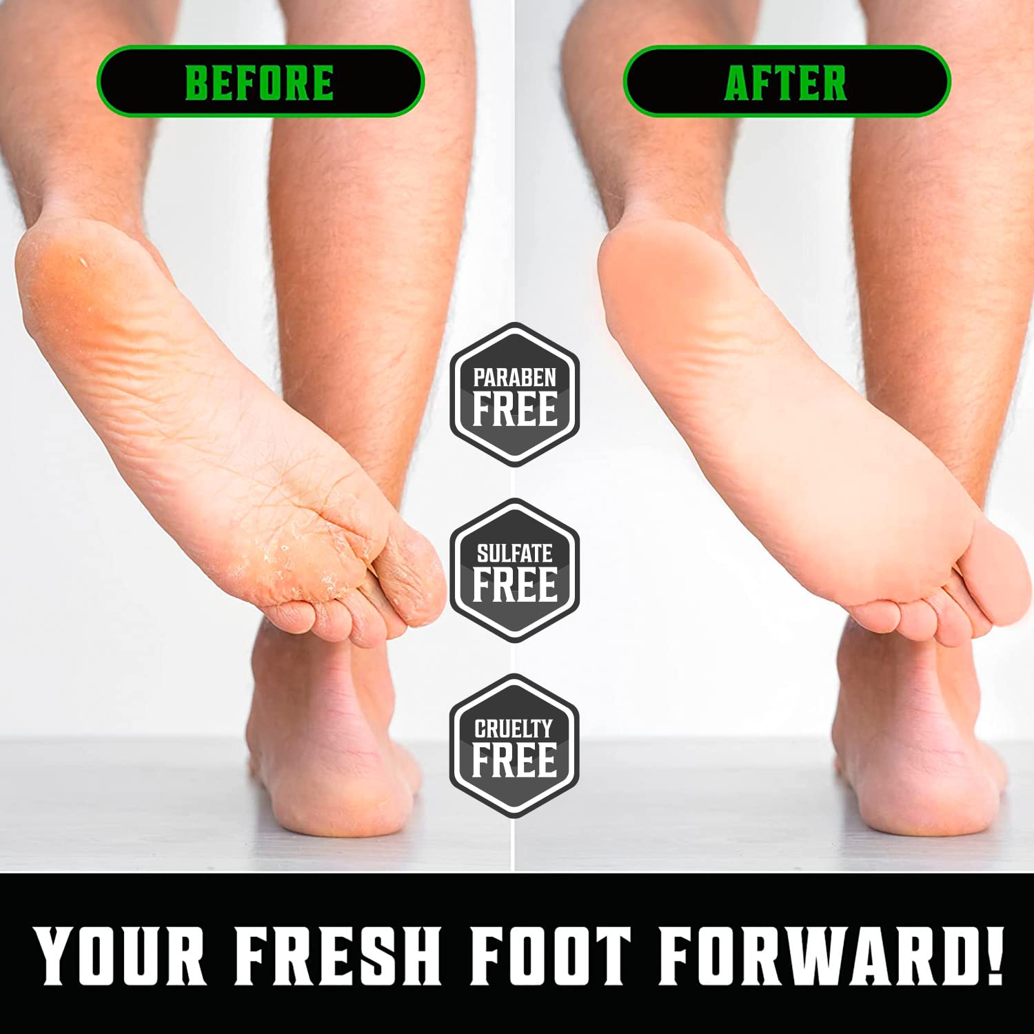 Witness the transformation of your feet before and after applying our Tea Tree Foot Cream for Dry Cracked Heels; your skin will look noticeably smoother. This treatment for dry feet is formulated with natural ingredients and is free from parabens, sulfates, and cruelty.